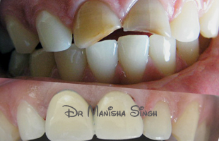 Cosmetic Dentistry